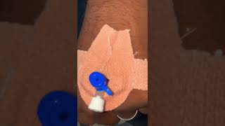 Intravenous IV cannulation procedure amp technique [upl. by Alyakcm202]