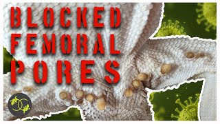 Squeezing Blocked Femoral Pores  should you do it  Cookies Critters [upl. by Acisej584]