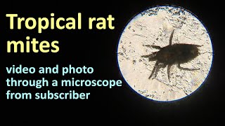 Tropical rat mites Ornithonyssus bacoti in the photo and video from our viewer [upl. by Pengelly]