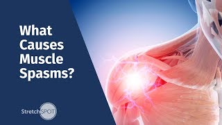 What Causes Muscle Spasms [upl. by Marillin253]