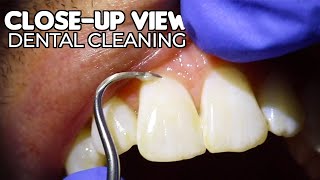 Dental Cleaning  CloseUp View ASMR [upl. by Aiekahs]