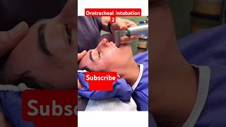 Orotracheal Intubation technique 2 health beauty hospital ivcannulation ivinsertion intubation [upl. by Asabi1]