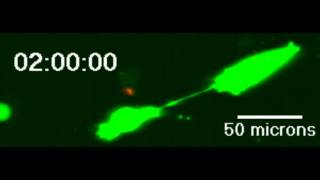 Example of intercellular transfer of proteins GFP via tunneling nanotubes connnecting cancer cells [upl. by Eiramenna]