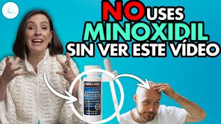 🔴 DERMATOLOGA te EXPLICA como APLICARTE MINOXIDIL ¿Efectos secundarios shedding Dra Pilar Ochoa [upl. by Arahat347]