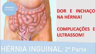 Sintomas da hérnia inguinal e as suas complicações  Fernando Eyer [upl. by Cleodal497]