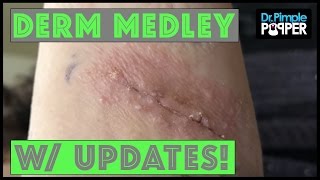 Derm Medley with Updates DerMedUpdates [upl. by Ralleigh]