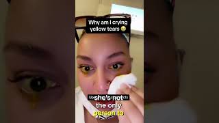 SHE WENT VIRAL FOR CRYING YELLOW TEARS WHY [upl. by Alanna]