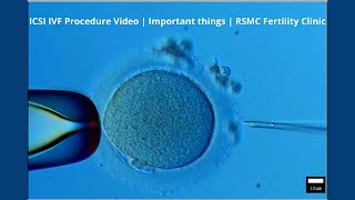 ICSI IVF Procedure Video  Important things  RSMC Fertility Clinic [upl. by Negris]