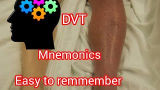 Mnemonics for deep vein thrombosis  risk factors  complications and treatment [upl. by Leksehcey]