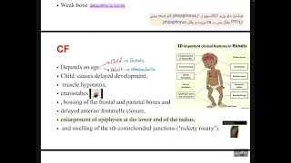 MBD4osteoporosis and osteomalacia [upl. by Bald]