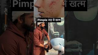 Pimple honge jad se khatam ek bar jarur try kre health trending trending shorts health tips [upl. by Hilbert]