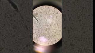 Giardia under the microscope  Veterinary Video [upl. by Nij]