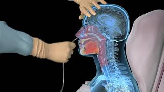 How to insert a nasogastric tube for NG intubation  3d animation [upl. by Yeldua3]