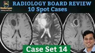 Radiology Board Core Exam Review Cases Quiz and Discussion  Set 14  Dec 2020 [upl. by Dviad622]