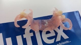 prótese flexivelPrótese flexível Sacavém Próteses dentárias estéticas Lisboasacavém [upl. by Atiras]