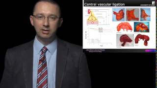 Complete Mesocolic Excision Pathological Quality Control [upl. by Auerbach769]