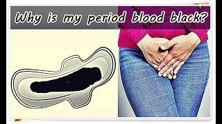 Black Period Blood – Meaning Causes Treatment Management [upl. by Fianna]