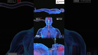 Liquid Ventilation Medical 3D Animation short [upl. by Naget497]