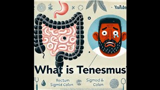 what is tenesmus and why does it occur [upl. by Esirahs276]