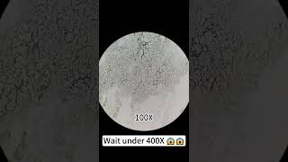 Pimples at 400X magnification are really cool underthemicroscope beefcut scienceshorts [upl. by Sila]