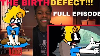 Haminations  “My Birth Defect” REACTION [upl. by Ydolem]