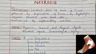 What Is Necrosis  Types Of Necrosis  Gross amp Microscopy  Pathology [upl. by Nonnairb511]