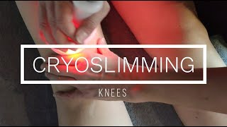 Cryoskin Révolution Tutorial cryoslimming knees session [upl. by Pitts]