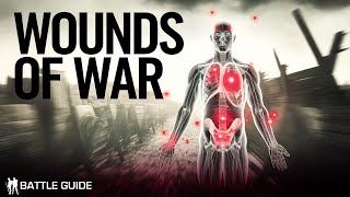 Wounded on The Western Front  A Death Sentence WW1 Documentary [upl. by Aihsekin]