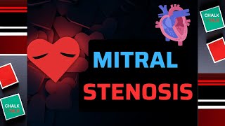 Mitral Valve Stenosis [upl. by Parthinia]