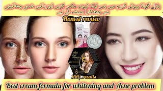 Best cream formula for whitening and Acne problemHonest reviewKOMAL beauty voice [upl. by Crispas]