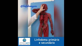 linfedema secundario e primario [upl. by Dyane]