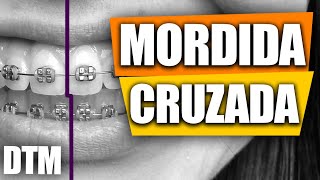 MORDIDA CRUZADA DTM [upl. by Akeenat991]