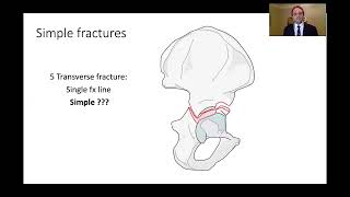 Kasr Al Ainy Postgraduate Orthopaedic Review Course  Acetabular Fractures Principles of Management [upl. by Sage31]