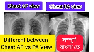 Different Between Chest AP View amp Chest PA View In Bengali [upl. by Ary]