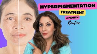 Hyperpigmentation treatment at home  Nipun Kapur [upl. by Ijan403]