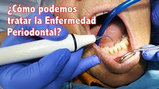 Enfermedad Periodontal II ¿Cómo podemos tratar la enfermedad periodontal [upl. by Dray103]