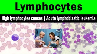 Lymphocytes  High lymphocytes causes  Acute lymphoblastic leukemia [upl. by Krystyna666]