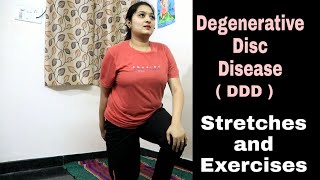 Degenerative Disc Disease DDD Treatment  DDD Stretches amp Exercises [upl. by Eked]