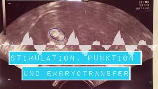 4ICSI  Stimulation Punktion und Embryotransfer was diesmal anders lief [upl. by Cnahc]