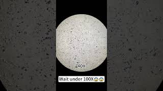 A pimple magnified 400X is seriously fascinatingunderthemicroscope microscope science [upl. by Jasen274]