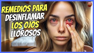 🔴 REMEDIOS CASEROS PARA DESINFLAMAR LOS OJOS LLOROSOS 🔴 [upl. by Jarlen]