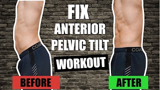 FIX quotAnterior Pelvic Tiltquot FAST  15 Min Home Workout INSTANT quotLOW BACKquot PAIN RELIEF [upl. by Euphemie571]