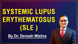 Systemic Lupus Erythematosus SLE by Dr Devesh Mishra [upl. by Ydur906]