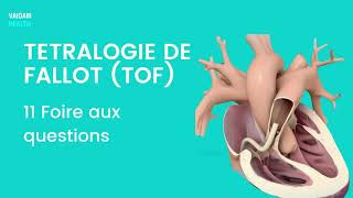 TETRALOGIE DE FALLOT TOF 11 Foire aux questions [upl. by Sherrard822]