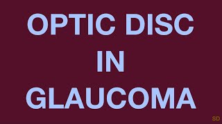 Glaucoma Session 06 Clinical Evaluation of a Glaucoma Patient Part 3 Fundus Examination [upl. by Nya]