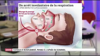 QUAND PENSER À L APNEE DU SOMMEIL [upl. by Allets]