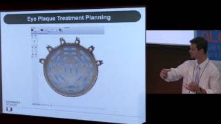 SAT  3  Radiation Physics and 3D Eye Plaque Treatment Planning Studenski [upl. by Assirim]