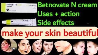 betnovate c skin cream  betnovate n  betnovate n ointment  betnovate n cream  betnovate n cream [upl. by Adnawyek53]