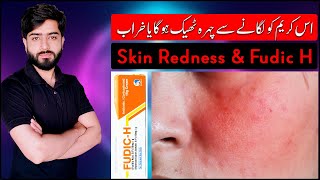 Skin Redness amp Fudic H Cream  Fusidic Acid  Hyderocortisone  Beauty Facts [upl. by Navonod]