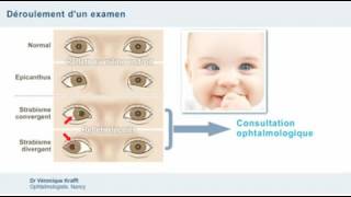 Examen ophtalmologique et dépistage des anomalies oculaires chez lenfant [upl. by Reprah]